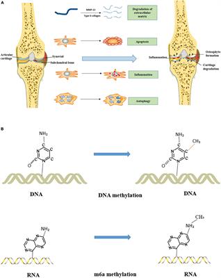 literature review on osteoarthritis